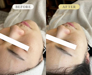 ビフォーアフター