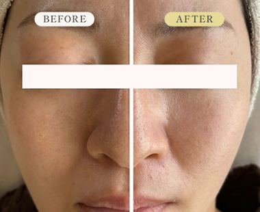 ビフォーアフター