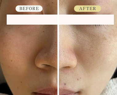 ビフォーアフター